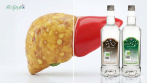 مقایسه بافت کبد چرب و کبد سالم پاکسازی شده توسط عرق کاسنی و شاتره افشار. 